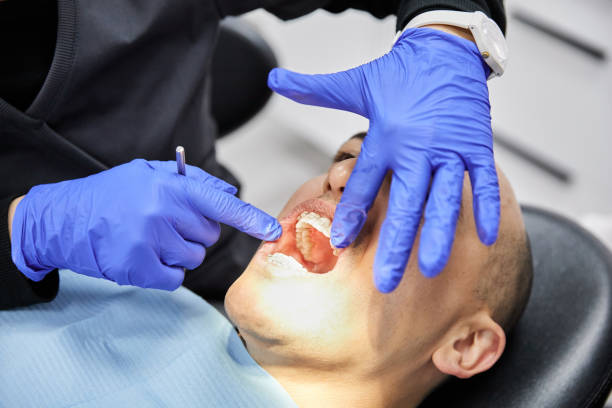 Best Emergency Root Canal Treatment in Bridgeport, WV